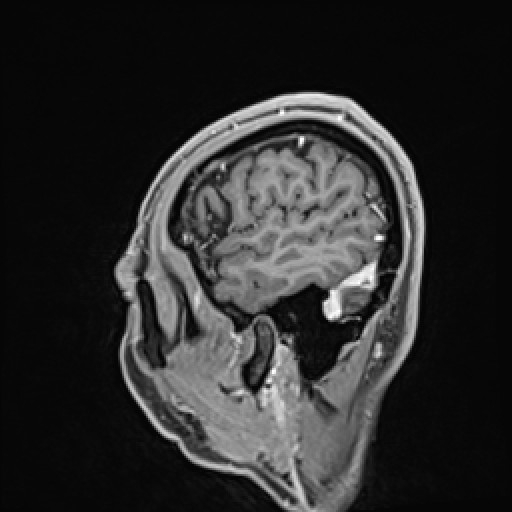 Click on the Serie image to view the images of VILLANUEVA, WILLIAM A.